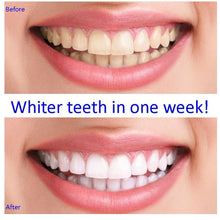Load image into Gallery viewer, TEETH WHITENING Kit -Electric Teeth LED Light Polishing Kit, Stain Remover, Teeth Cleaning Tools, 5 Polishing Cups, Press To Activate A Brighter &amp; Whiter Smile